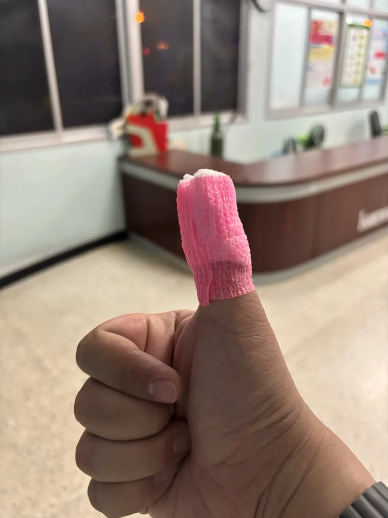 เอาไปเลย หนึ่งนิ้วโป้งงงง